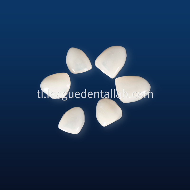 IPS Empress,Emax Onlay,Emax onlay,Emax Veneer,Lithium disilicate